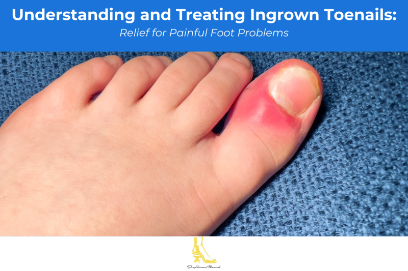 Understanding and Treating Ingrown Toenails: Relief for Painful Foot Problems