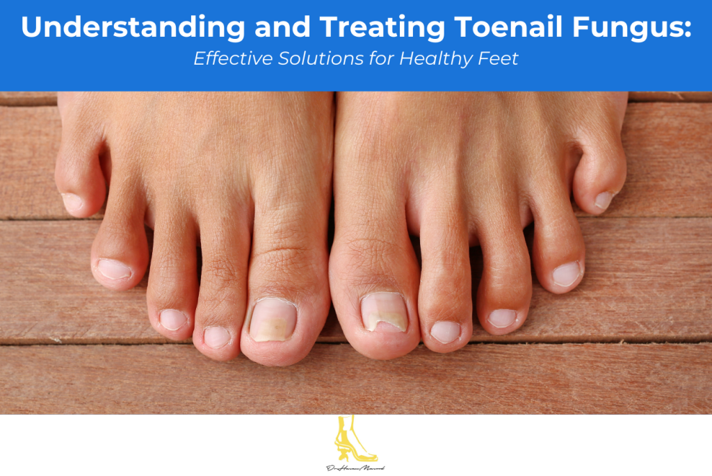Understanding and Treating Toenail Fungus Effective Solutions for Healthy Feet